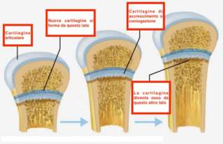 cartilagine-coniugazione-schema cartilagine-coniugazione-crescita-bambino